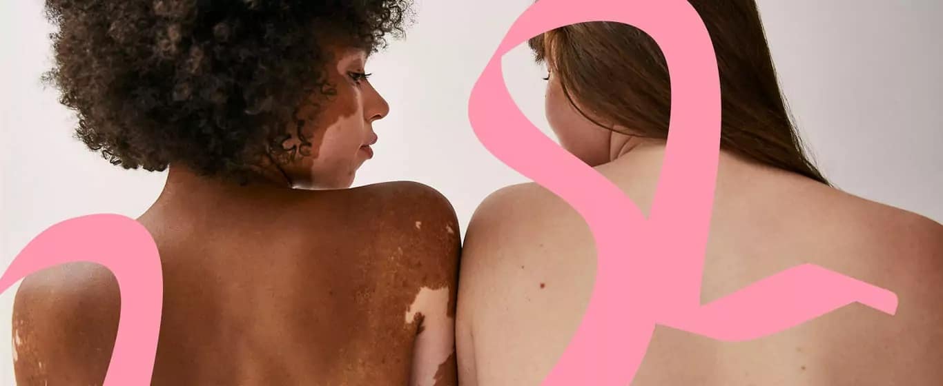 Diversity Marketing Beispiele HelloBody Hautfarben Pigmentstörungen Haut