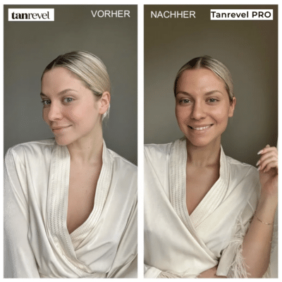 TANREVEL VORHER NACHHER ERGEBNIS ERFAHRUNG BILDER FOTOS ANWEDNUNG