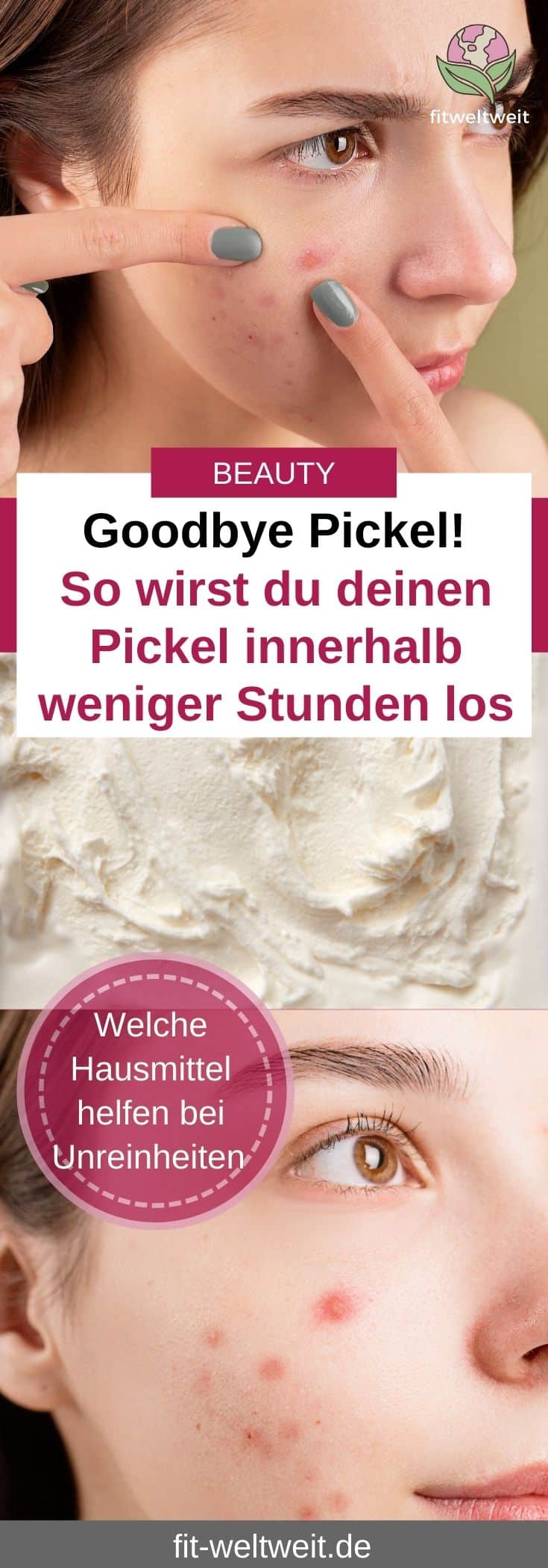 Goodbye Pickel! So wirst du deinen Pickel innerhalb weniger Stunden wieder los. Welche Hausmittel am besten helfen können bei Hautunreinheiten