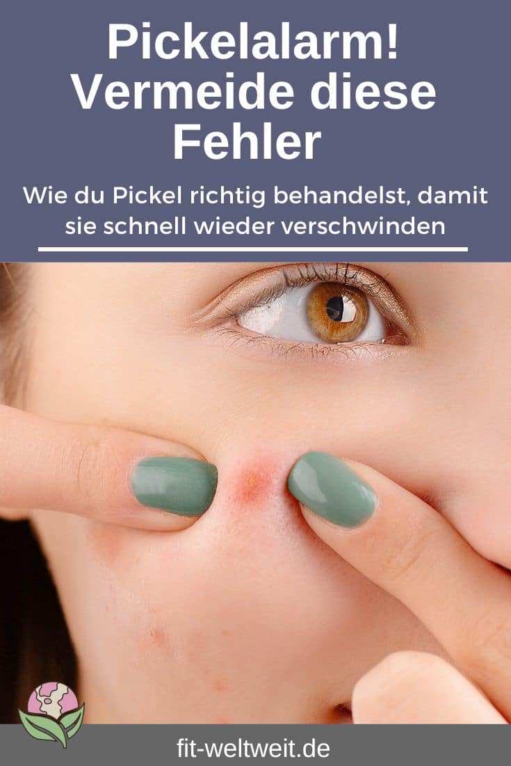 Pickelalarm! So wirst du den Quälgeist schnell wieder los! Wie du Pickel behandelst, damit sie schnell wieder verschwinden. Meine Erfahrungen