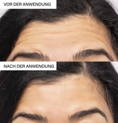 Erfahrungen vorher nachher BOTANICAL LIFTING Effect Mask Test Rosental Organics