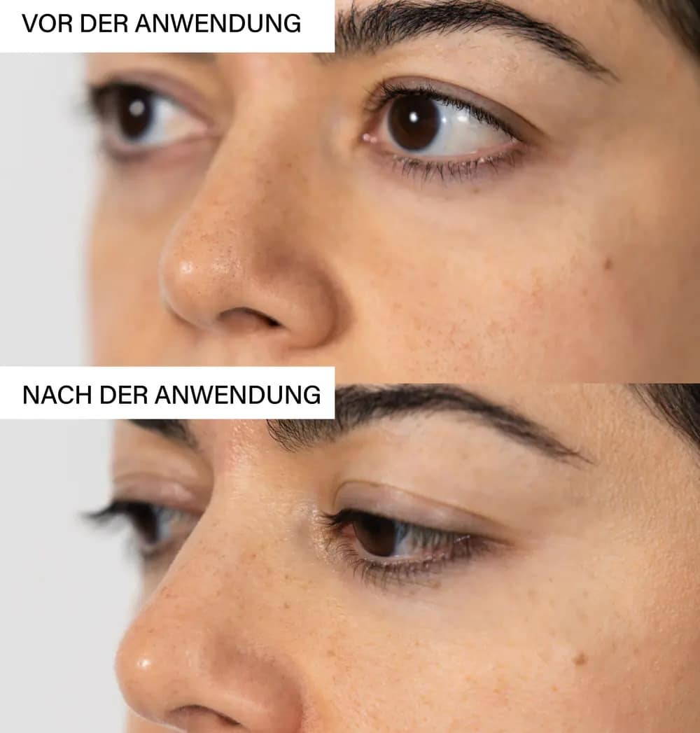 vorher nachher Bild Skin Exfoliating Peeling Rosental Organics Erfahrungen
